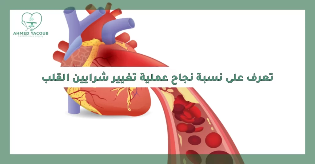 نسبة نجاح عملية تغيير شرايين القلب